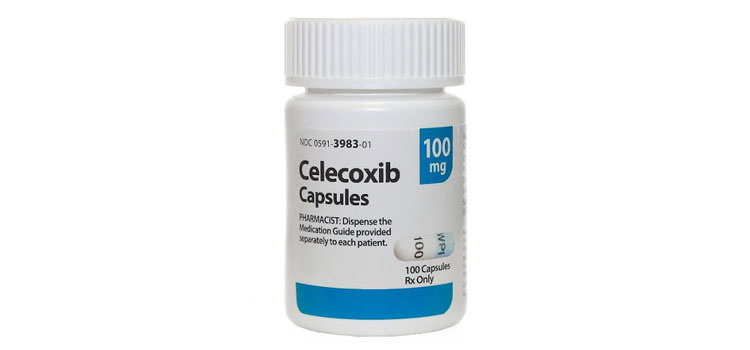order cheaper celecoxib online in Mission, SD